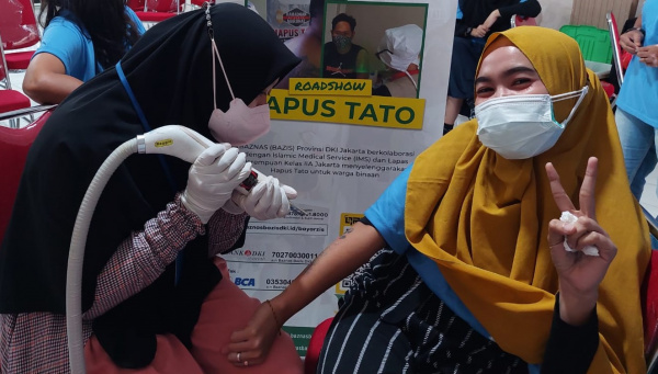 Ramadhan, BAZIS DKI-IMS Berikan Layanan Hapus Tato untuk 34 Warga Binaan Pemasyarakatan